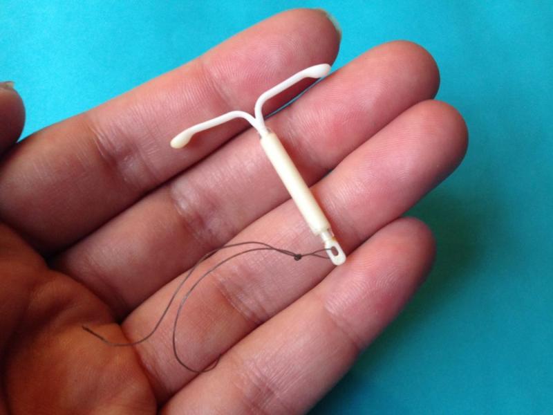 How Much Does Mirena Iud Cost