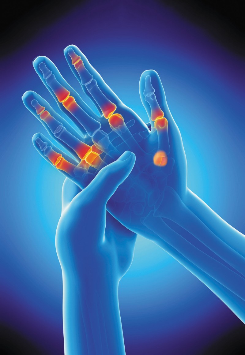 What Are The Two Types Of Arthritis